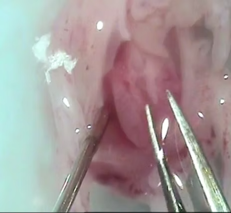 Gene Editing Process